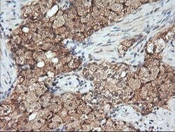 MAP2K1 Monoclonal Antibody (OTI8A6), TrueMAB , OriGene 100 &mu;L; Unconjugated:Antibodies,