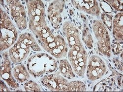 MAP2K1 Monoclonal Antibody (OTI8A6), TrueMAB , OriGene 100 &mu;L; Unconjugated:Antibodies,