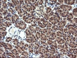 MAP2K1 Monoclonal Antibody (OTI1A10), TrueMAB , OriGene 100 &mu;L; Unconjugated:Antibodies,