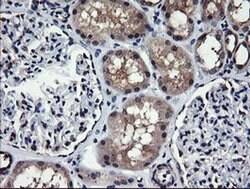 MAP2K1 Monoclonal Antibody (OTI1A10), TrueMAB , OriGene:Antibodies:Primary
