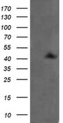 MAP2K1 Monoclonal Antibody (OTI2D4), TrueMAB , OriGene 100 &mu;L; Unconjugated:Antibodies,