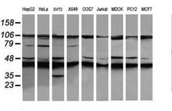 MAP2K1 Monoclonal Antibody (OTI2D4), TrueMAB , OriGene 100 &mu;L; Unconjugated:Antibodies,