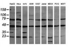 MAP2K1 Monoclonal Antibody (OTI2H3), TrueMAB , OriGene 100 &mu;L; Unconjugated:Antibodies,