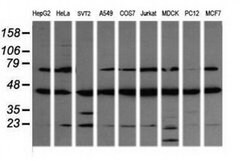 MAP2K1 Monoclonal Antibody (OTI2G5), TrueMAB , OriGene 100 &mu;L; Unconjugated:Antibodies,