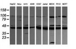 MAP2K1 Monoclonal Antibody (OTI1E5), TrueMAB , OriGene 100 &mu;L; Unconjugated:Antibodies,