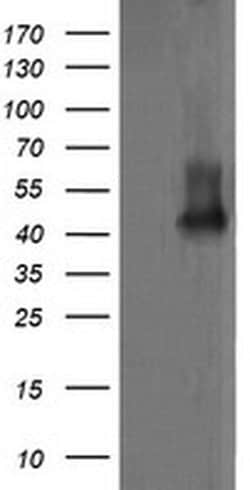 MAP2K1 Monoclonal Antibody (OTI3B4), TrueMAB , OriGene 100 &mu;L; Unconjugated:Antibodies,