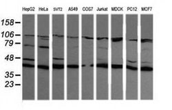MAP2K1 Monoclonal Antibody (OTI3B4), TrueMAB , OriGene 100 &mu;L; Unconjugated:Antibodies,