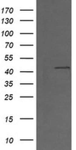 MAP2K1 Monoclonal Antibody (OTI2B7), TrueMAB , OriGene 100 &mu;L; Unconjugated:Antibodies,