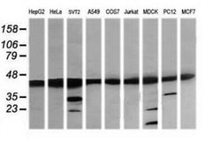 MAP2K1 Monoclonal Antibody (OTI2B7), TrueMAB , OriGene 100 &mu;L; Unconjugated:Antibodies,