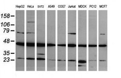 MAP2K1 Monoclonal Antibody (OTI3H5), TrueMAB , OriGene 100 &mu;L; Unconjugated:Antibodies,