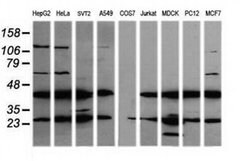 MAP2K1 Monoclonal Antibody (OTI4H1), TrueMAB , OriGene 100 &mu;L; Unconjugated:Antibodies,