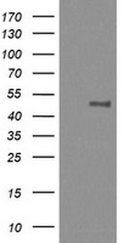 MAP2K1 Monoclonal Antibody (OTI4B1), TrueMAB , OriGene 100 &mu;L; Unconjugated:Antibodies,