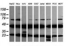 MAP2K1 Monoclonal Antibody (OTI4B1), TrueMAB , OriGene 100 &mu;L; Unconjugated:Antibodies,