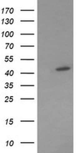 MAP2K1 Monoclonal Antibody (OTI2F1), TrueMAB , OriGene:Antibodies:Primary