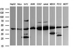 MAP2K1 Monoclonal Antibody (OTI2F1), TrueMAB , OriGene:Antibodies:Primary
