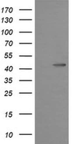 MAP2K1 Monoclonal Antibody (OTI1A9), TrueMAB , OriGene 100 &mu;L; Unconjugated:Antibodies,
