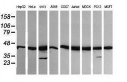 MAP2K1 Monoclonal Antibody (OTI1A9), TrueMAB , OriGene 100 &mu;L; Unconjugated:Antibodies,