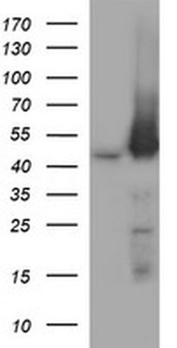 MAP2K1 Monoclonal Antibody (OTI5D3), TrueMAB , OriGene 100 &mu;L; Unconjugated:Antibodies,