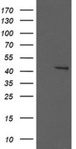 MAP2K1 Monoclonal Antibody (OTI1F4), TrueMAB , OriGene 30 &mu;L; Unconjugated:Antibodies,