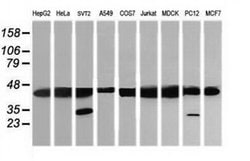 MAP2K1 Monoclonal Antibody (OTI1F4), TrueMAB , OriGene 30 &mu;L; Unconjugated:Antibodies,