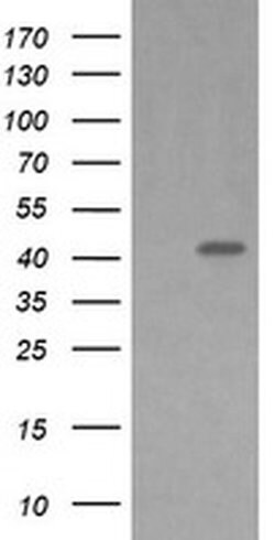 MAP2K1 Monoclonal Antibody (OTI2E8), TrueMAB , OriGene 100 &mu;L; Unconjugated:Antibodies,