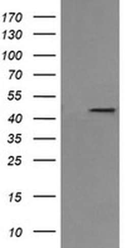 MAP2K1 Monoclonal Antibody (OTI7F3), TrueMAB , OriGene 100 &mu;L; Unconjugated:Antibodies,