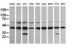 MAP2K1 Monoclonal Antibody (OTI7F3), TrueMAB , OriGene 100 &mu;L; Unconjugated:Antibodies,