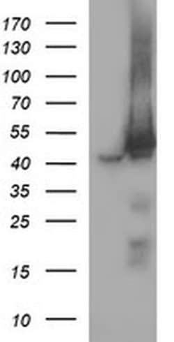 MAP2K1 Monoclonal Antibody (OTI9E9), TrueMAB , OriGene 100 &mu;L | Buy Online | OriGene | Fisher Scientific