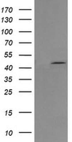 MAP2K1 Monoclonal Antibody (OTI8H1), TrueMAB , OriGene 100 &mu;L; Unconjugated:Antibodies,