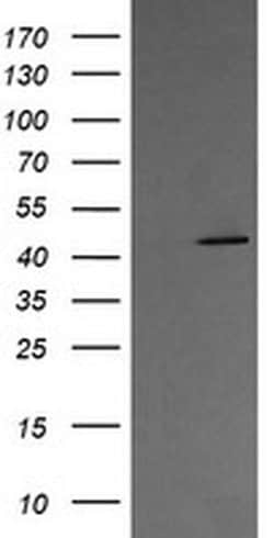 MAP2K1 Monoclonal Antibody (OTI8A6), TrueMAB , OriGene 100 &mu;L; Unconjugated:Antibodies,