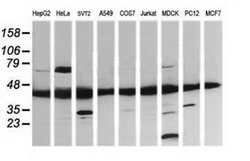 MAP2K1 Monoclonal Antibody (OTI1A10), TrueMAB , OriGene 100 &mu;L; Unconjugated:Antibodies,
