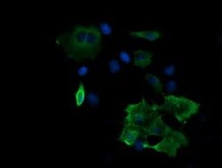 MAP2K2 Monoclonal Antibody (OTI5G8), TrueMAB , OriGene 100 &mu;L; Unconjugated:Antibodies,