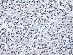 MAP2K2 Mouse anti-Human, Clone: OTI8G6, lyophilized, TrueMAB 100 &mu;g;