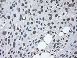 MAP2K2 Mouse anti-Human, Clone: OTI8G6, lyophilized, TrueMAB 100 &mu;g;