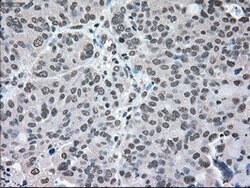 MAP2K2 Mouse anti-Human, Clone: OTI8G6, lyophilized, TrueMAB 100 &mu;g;