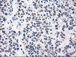 MAP2K2 Mouse anti-Human, Clone: OTI8G6, lyophilized, TrueMAB 100 &mu;g;