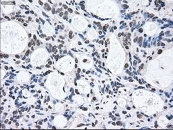 MAP2K2 Mouse anti-Human, Clone: OTI8G6, lyophilized, TrueMAB 100 &mu;g;