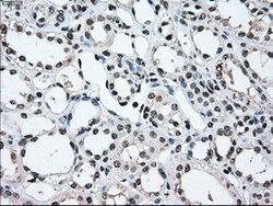 MAP2K2 Mouse anti-Human, Clone: OTI8G6, lyophilized, TrueMAB 100 &mu;g;