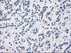 MAP2K2 Mouse anti-Human, Clone: OTI8G6, lyophilized, TrueMAB 100 &mu;g;