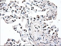 MAP2K2 Mouse anti-Human, Clone: OTI8G6, lyophilized, TrueMAB 100 &mu;g;
