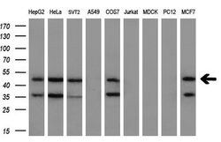 MAP2K2 Mouse anti-Human, Clone: OTI8G6, lyophilized, TrueMAB 100 &mu;g;