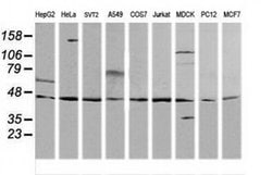 MAP2K2 Monoclonal Antibody (OTI5G8), TrueMAB , OriGene 100 &mu;L; Unconjugated:Antibodies,