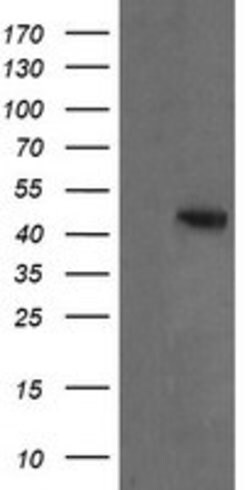 MAP2K2 Mouse anti-Canine, Human, Mouse, Clone: OTI5B4, lyophilized, TrueMAB