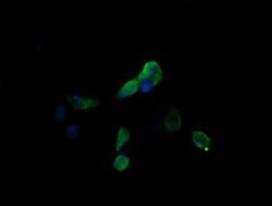MAP2K3 Monoclonal Antibody (OTI3C8), TrueMAB , OriGene 100 &mu;L; Unconjugated:Antibodies,