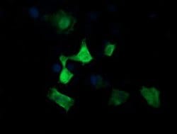 MAP2K3 Monoclonal Antibody (OTI1B5), TrueMAB , OriGene 100 &mu;L; Unconjugated:Antibodies,