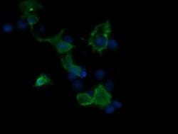 MAP2K3 Monoclonal Antibody (OTI2A7), TrueMAB , OriGene:Antibodies:Primary