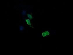 MAP2K3 Monoclonal Antibody (OTI6B11), TrueMAB , OriGene 100 &mu;L; Unconjugated:Antibodies,