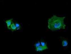 MAP2K3 Monoclonal Antibody (OTI5E2), TrueMAB , OriGene 100 &mu;L; Unconjugated:Antibodies,