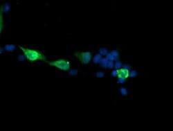 MAP2K3 Monoclonal Antibody (OTI5F9), TrueMAB , OriGene 100 &mu;L; Unconjugated:Antibodies,