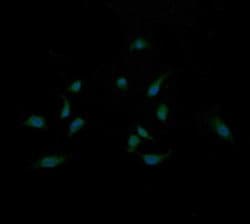 MAP2K3 Monoclonal Antibody (OTI5B2), TrueMAB , OriGene 100 &mu;L; Unconjugated:Antibodies,